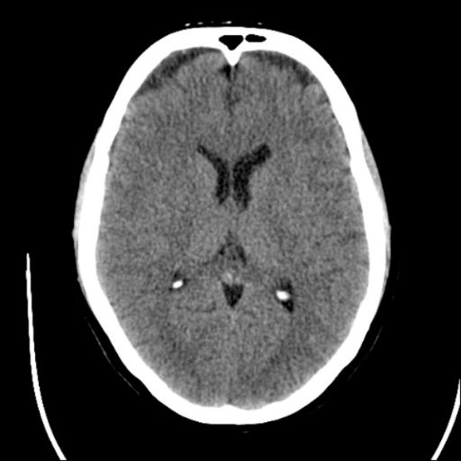 Central Nervous System