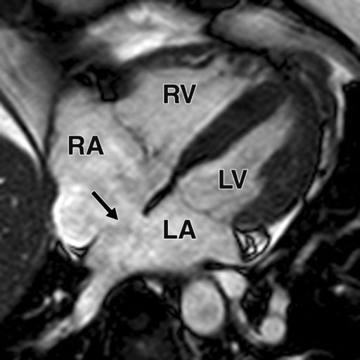 Cardiovascular System